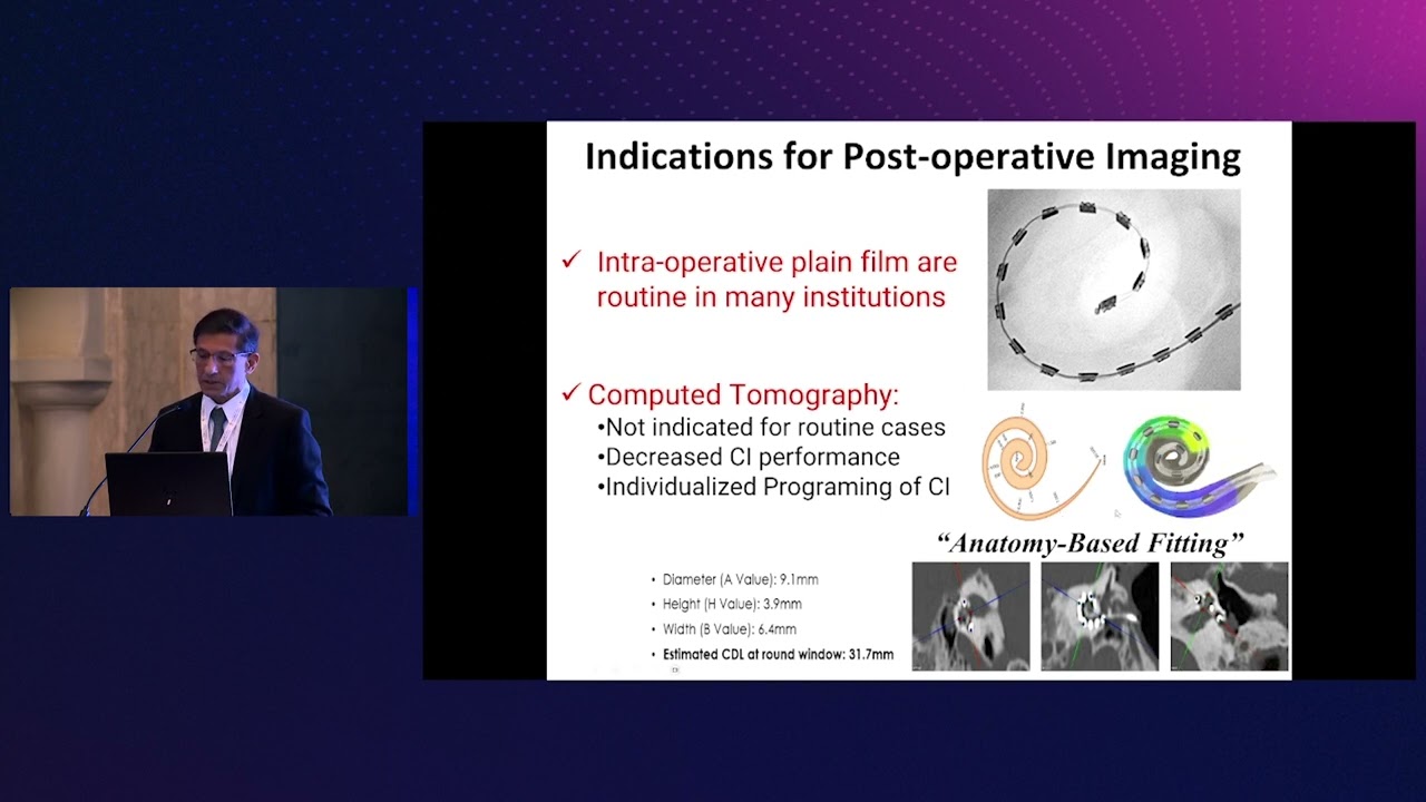 Post-operative imaging of cochlear implants | Prof. Suresh K. Mukherji