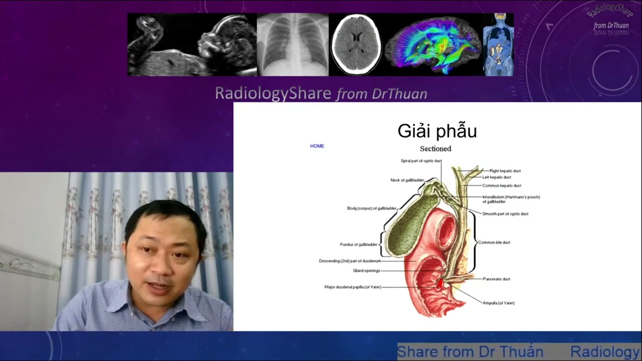 Siêu âm túi mật - đường mật 2021- Phần 6