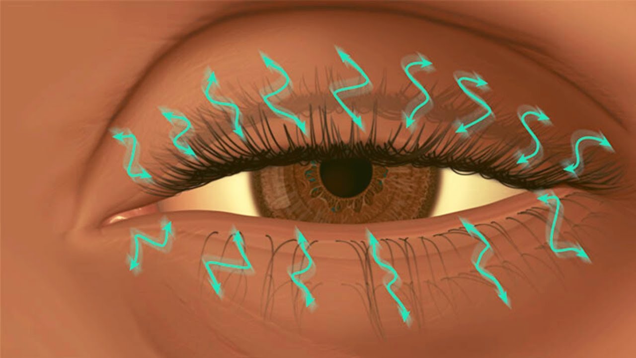 Temblor en el ojo: qué es, qué lo causa y cómo se trata (blefaroespasmo, tic en ojo, mioquimia)