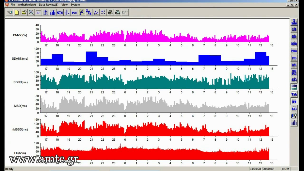 Holter Software Report   12 leads ECG   Contec TLC5000%2C www amtc gr