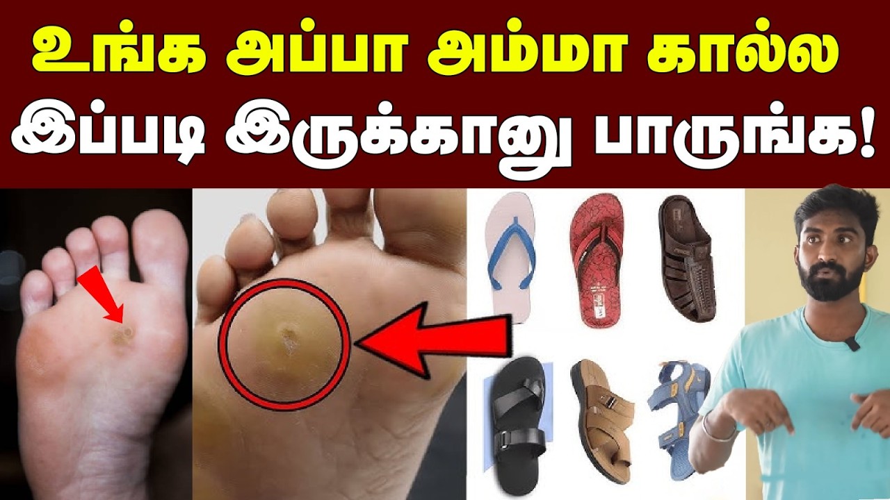 இதையெல்லாம் சாதாரணமா நினைக்காதீங்க மக்களே😱🙏🏻 | உடனே கவனிங்க | Callus | கால் ஆணி | Callus Symptoms