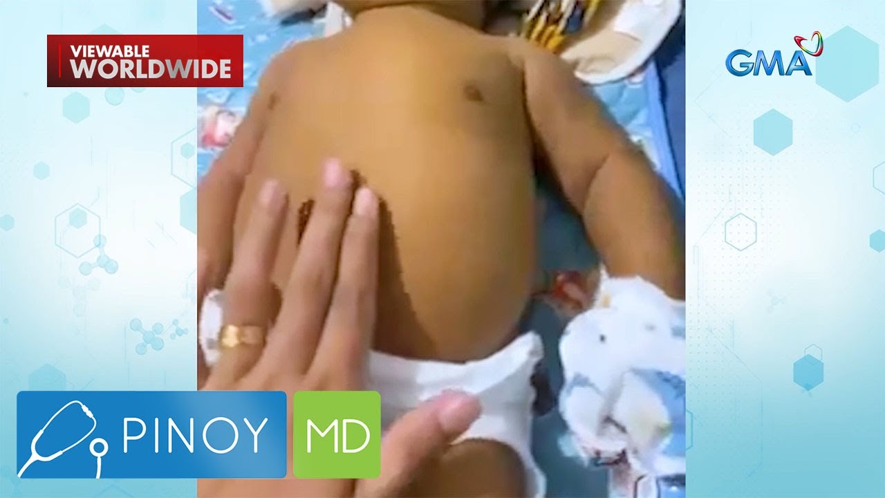Viral video ng sanggol na malaki ang tiyan at nanghihina, ano nga ba ang karamdaman? | Pinoy MD