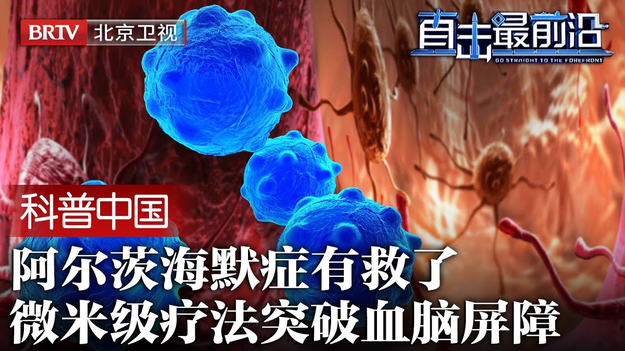 攻破“阿兹海默症”难题，中国微米级疗法问世，突破血脑屏障，欧美药企研发宣告失败【科普中国直击最前沿】