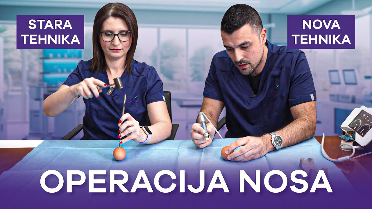 Kako se lomi nosna kost kod operacije nosa? | Ultrazvučna rinoplastika vs klasična / stara tehnika