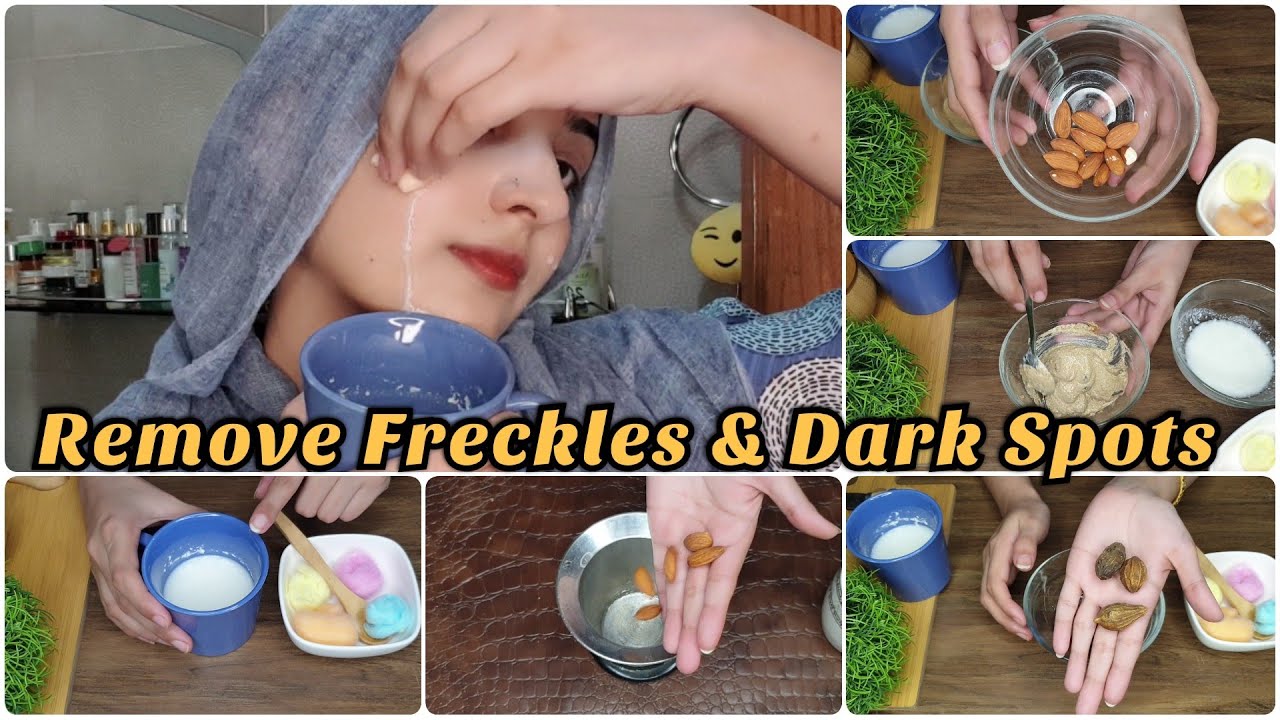 Just Apply & See Results to Remove Freckles, Dark Spots & Pigmentation