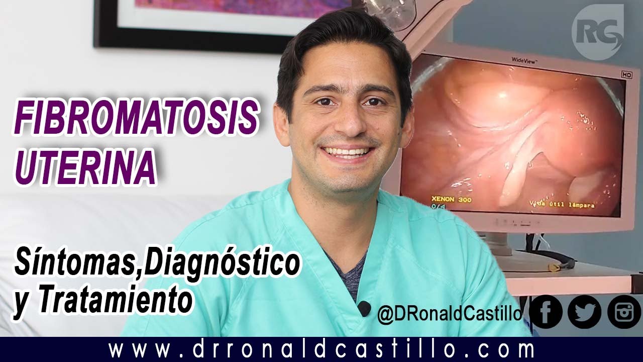 MIOMAS UTERINOS: DEFINICI&Oacute;N, S&Iacute;NTOMAS, DIAGN&Oacute;STICO Y TRATAMIENTO