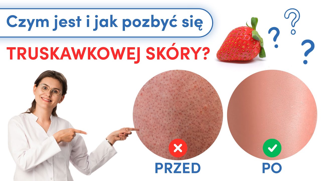 Truskawkowa skóra po goleniu. Jak się jej pozbyć?
