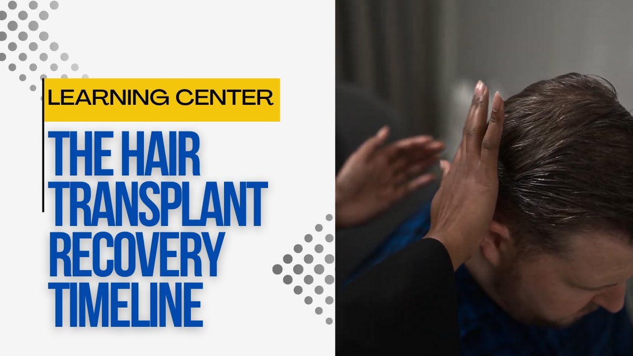 Day 1 to 1 Year: The Hair Transplant Recovery Timeline They Don’t Tell You About