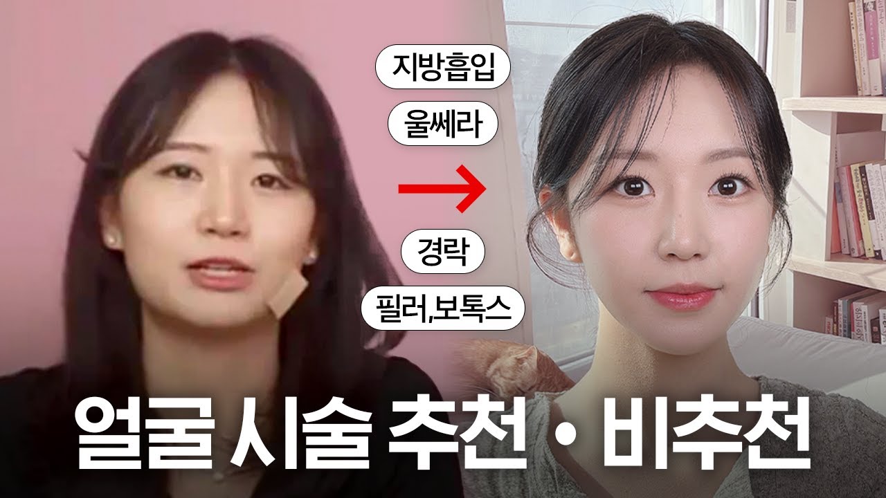 지금까지 받았던 시술 전부 공개합니다..🤫 성형•시술 추천 vs 비추천 (3만원~500만원) | 옌마드