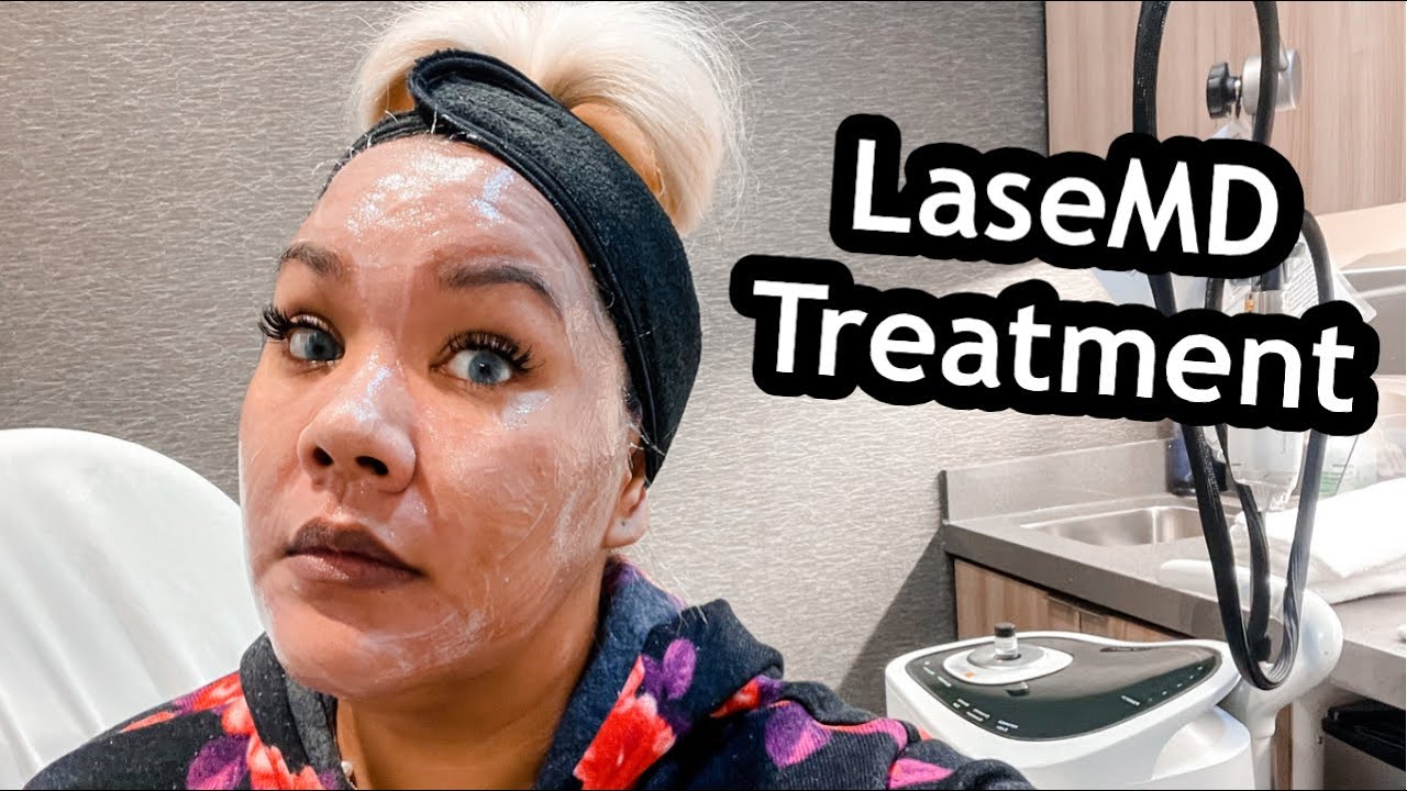 LaseMD Before And After | LaseMD Treatment | Laser Treatment Before And After | It Didn't Even Hurt!