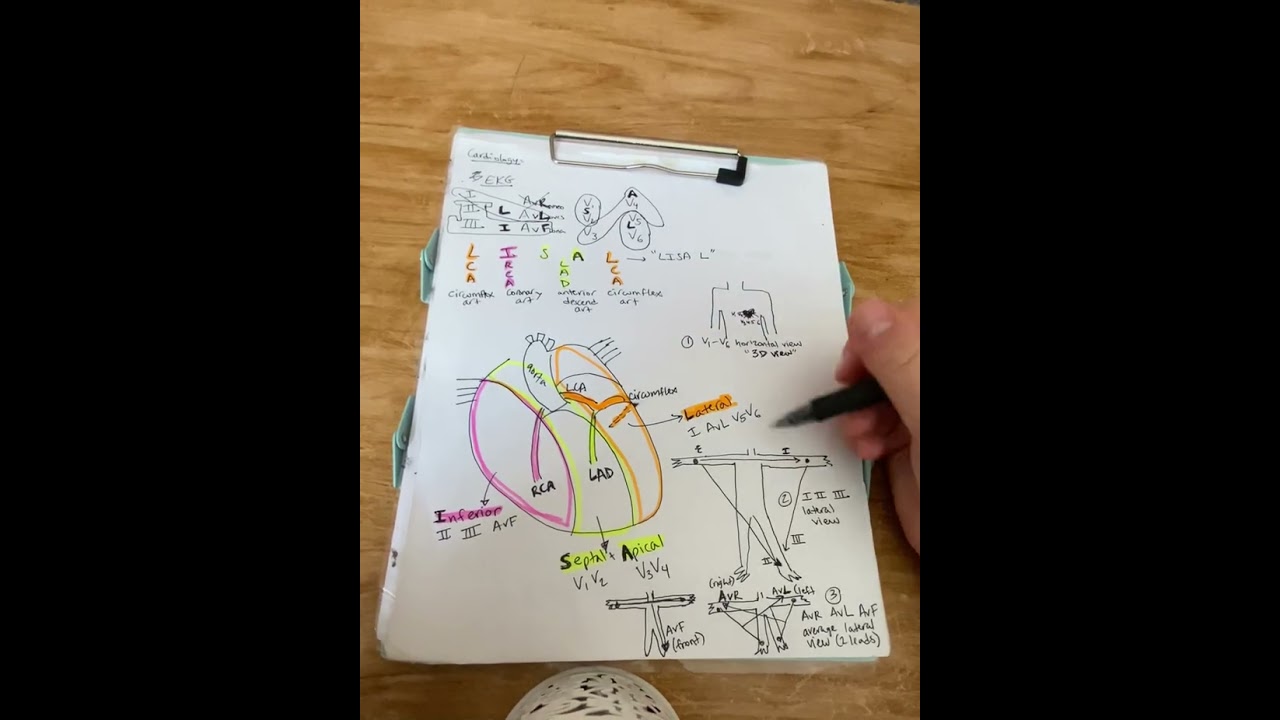 PCCN Review - ECG/EKG leads 
