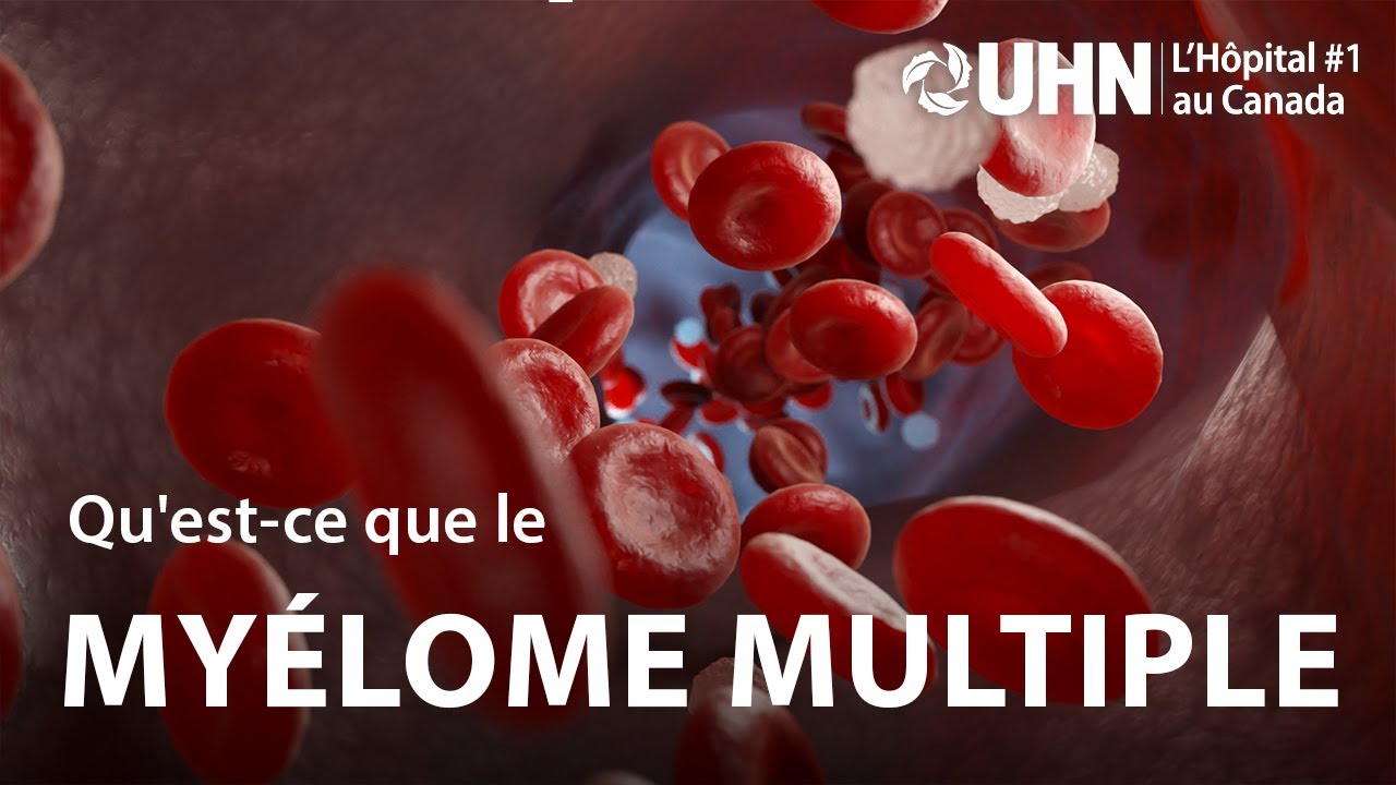 L'UHN Explique: Myélome multiple | UHN Explains: Multiple Myeloma