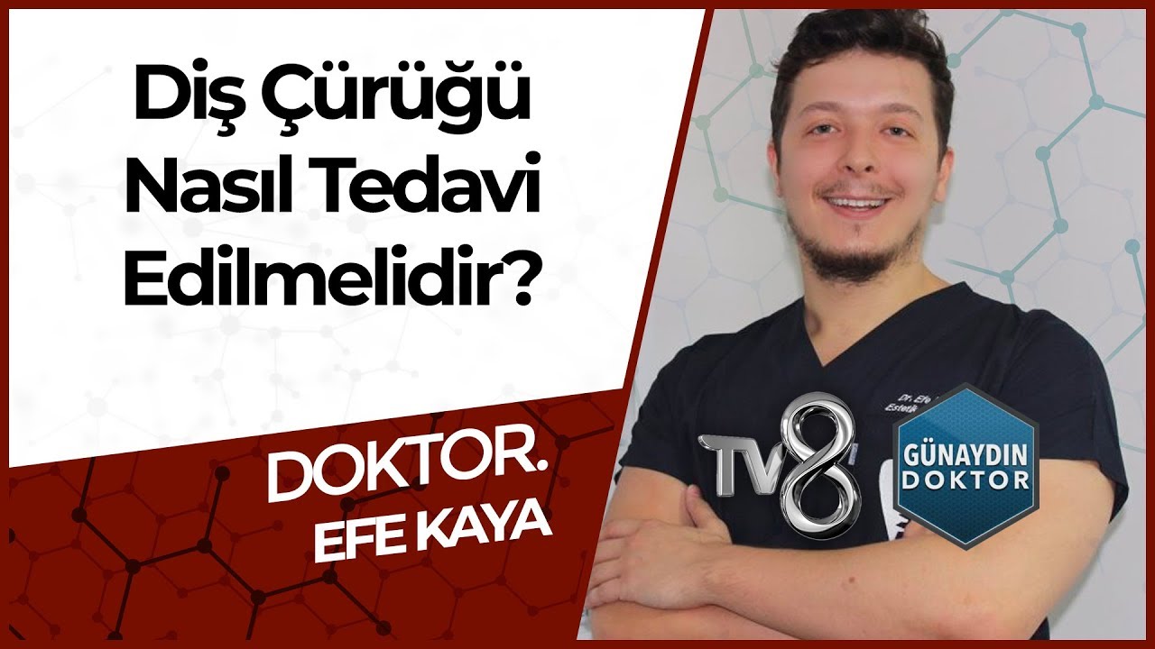 Bonding Uygulaması İle Diş Estetiği Nasıl Yapılır? - DR. Efe KAYA
