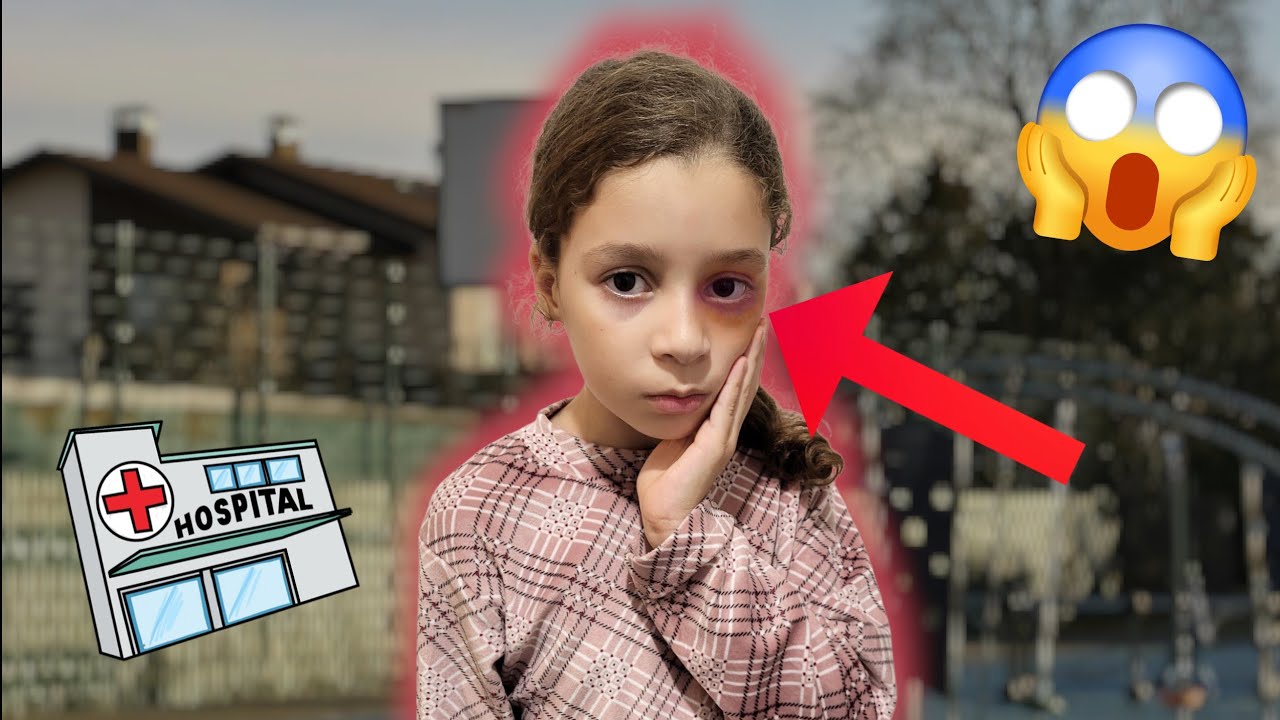 Qui a Fait mal à ma Fille Mouna à son oeil !?