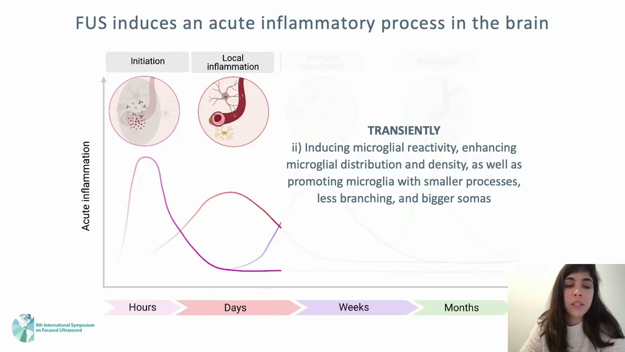 Elisa GonÁalves de Andrade: Determining the Outcomes of FUS-Mediated BBB Permeability on Microglia