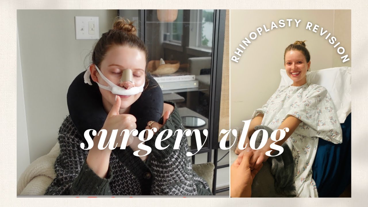 VLOG: it's surgery time (rhinoplasty revision experience!)