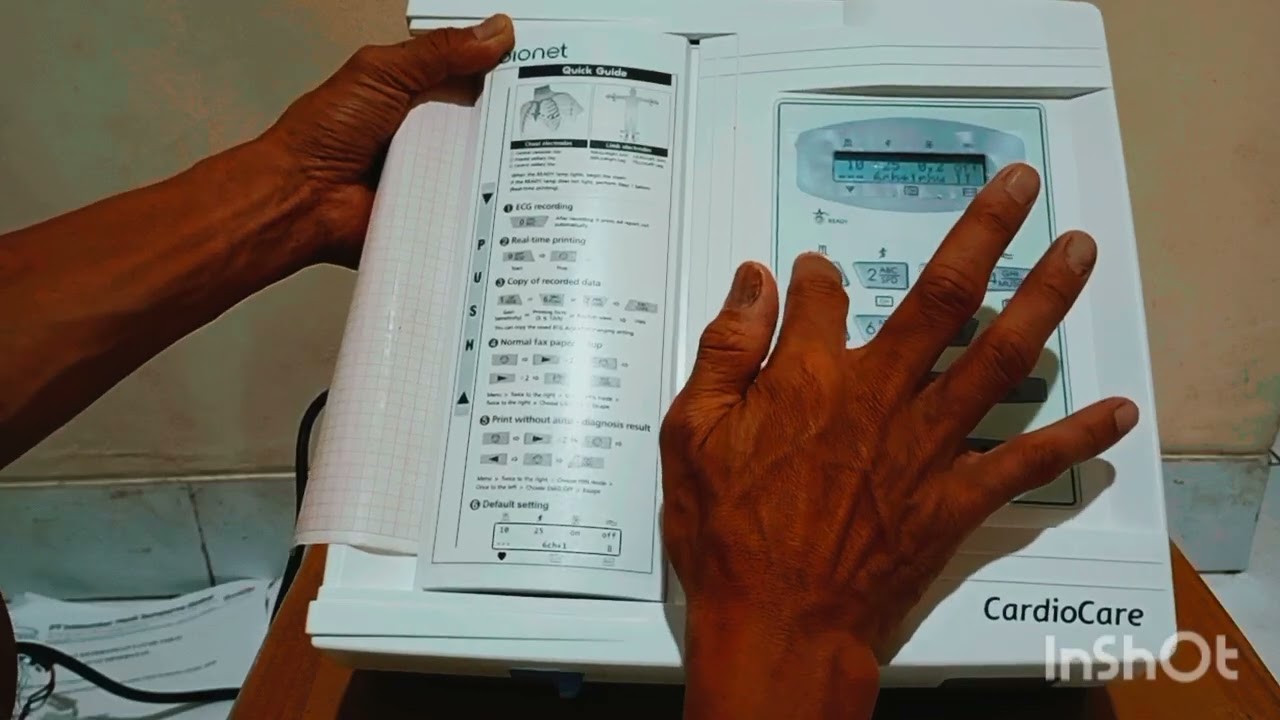 Electrocardiography 12 Channel Bionet | EKG Cardiocare 2000 Bionet