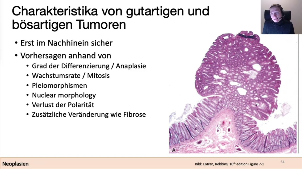 VL Dynamik im Gewebe Teil 4 Neoplasien