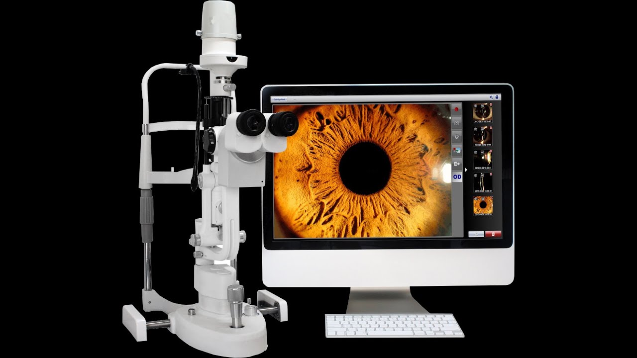 [Phoenix-1]How to install Phoenix digital imaging  module onto slit lamp?