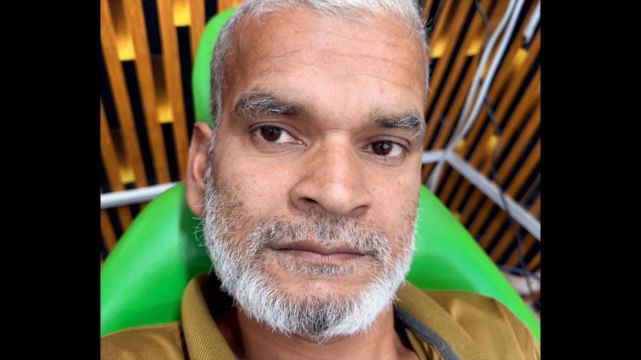 আক্কেল দাঁত তুলতে ভয়ের কিছু নাই লাইভটি দেখুন