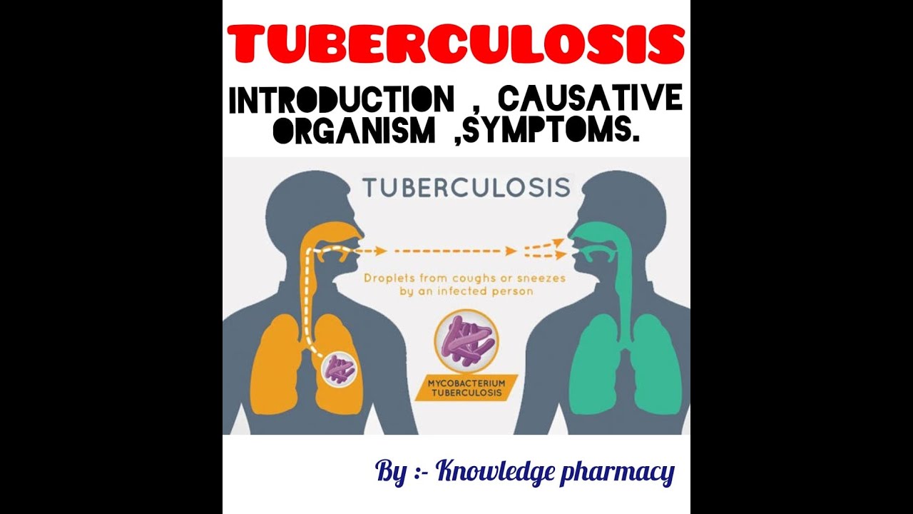 TUBERCULOSIS , SIGN & SYMPTOMS   . TB , TEST , MANTOUX TEST , PHARMACY