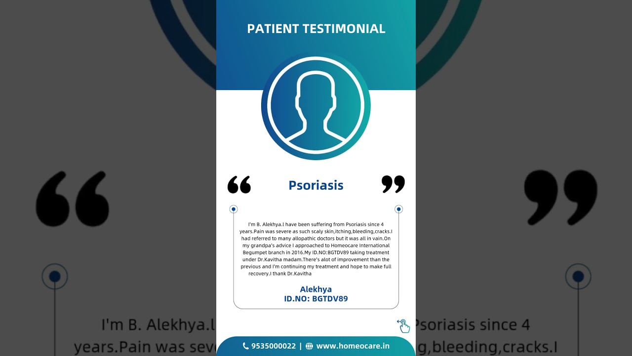 Homeocare International Psoriasis Treatment Review | Homeopathy Treatment for Psoriasis Testimonial