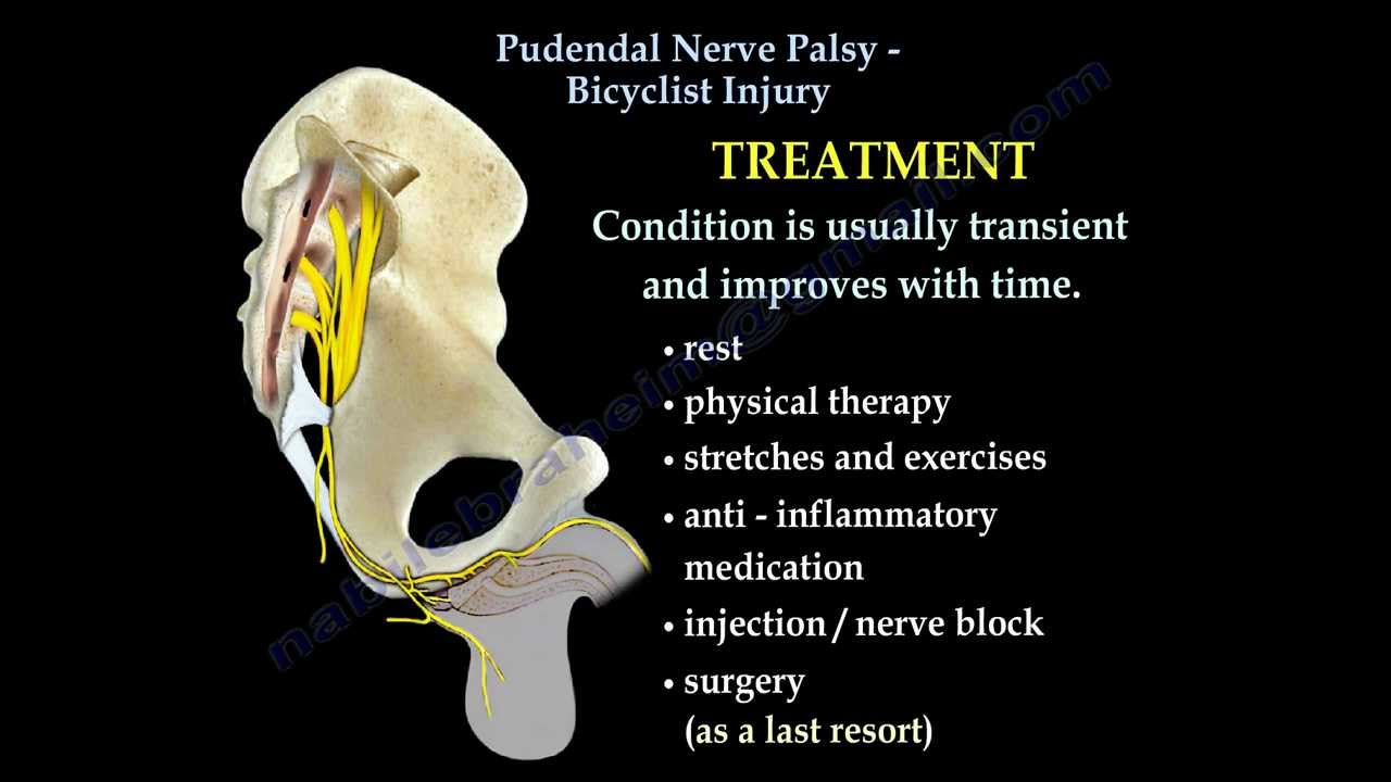 Pudendal Nerve Palsy Bicyclist nerve  Injury - Everything You Need To Know - Dr. Nabil Ebraheim