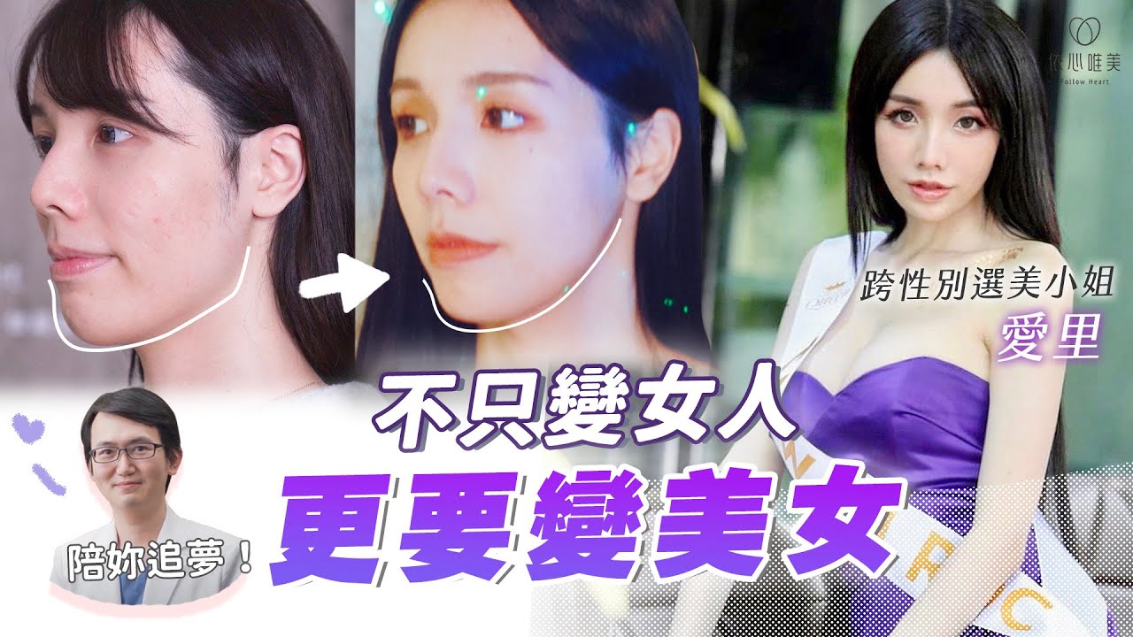 選美前為何整形？陽剛→甜美關鍵竟是㊙愛里真心話公開 下巴截骨 削骨｜依心唯美 謝東穎醫師 ft.愛里@AllieAllie​