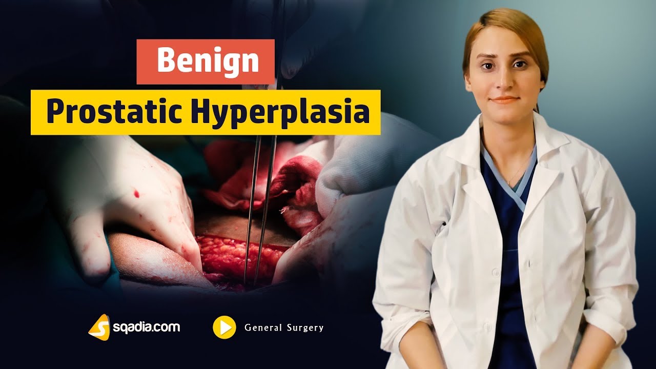 Benign Prostatic Hyperplasia | General Surgery Education | Online Lecture Trailer | V-Learning