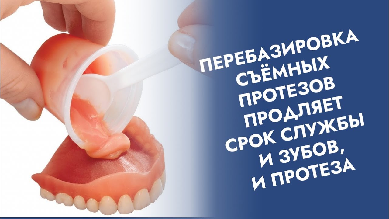 Съёмные протезы. Перебазировка=починка.
