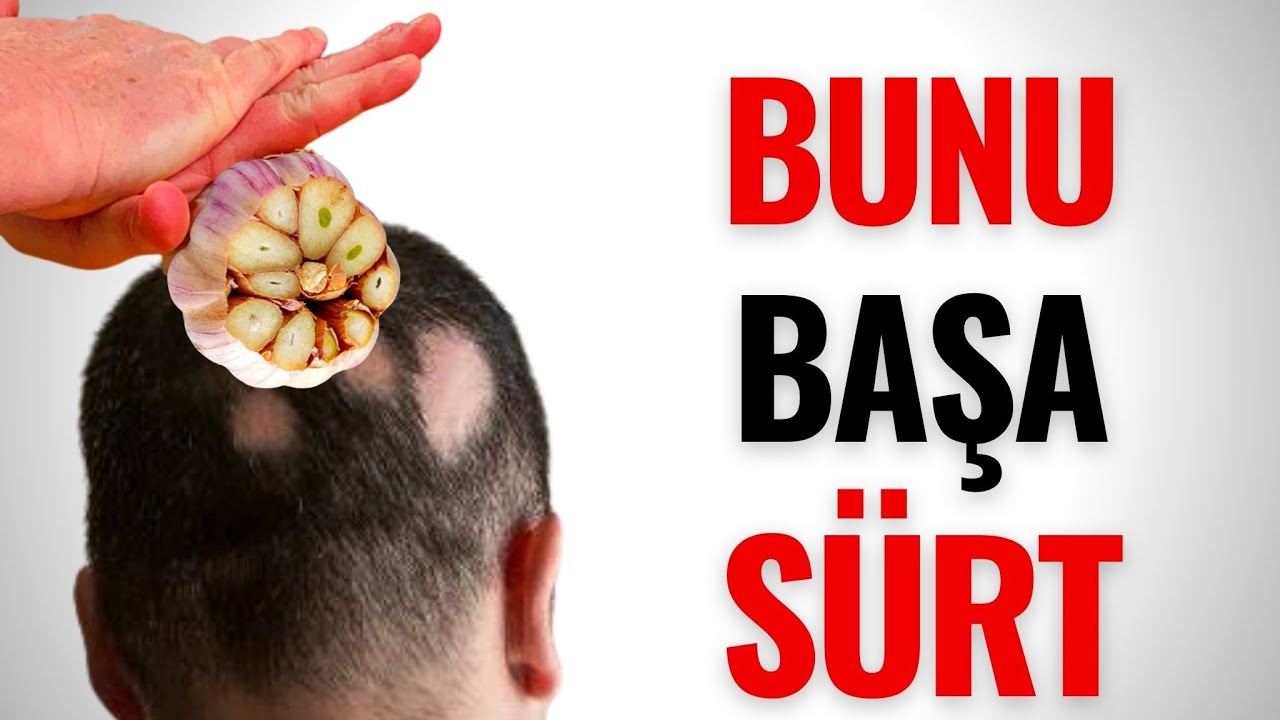 Sarımsağı Başınıza Sürtün! - Bir Gecəyə Görün Nə Baş Verəcək!