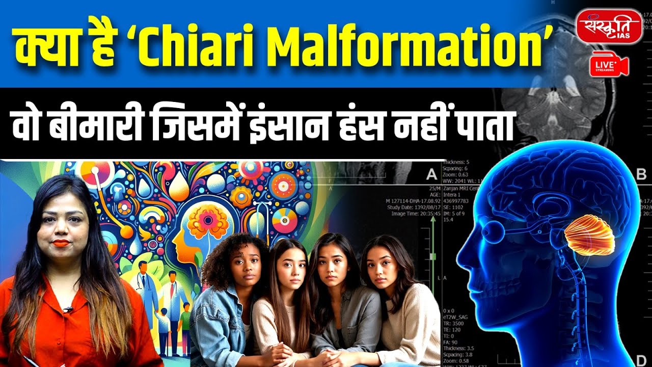 What is Chiari Malformation? | The Rare Brain Disease That Stops People from Laughing |Sanskriti IAS