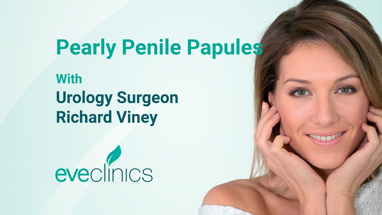 Pearly Penile Papule Treatment - Richard Viney