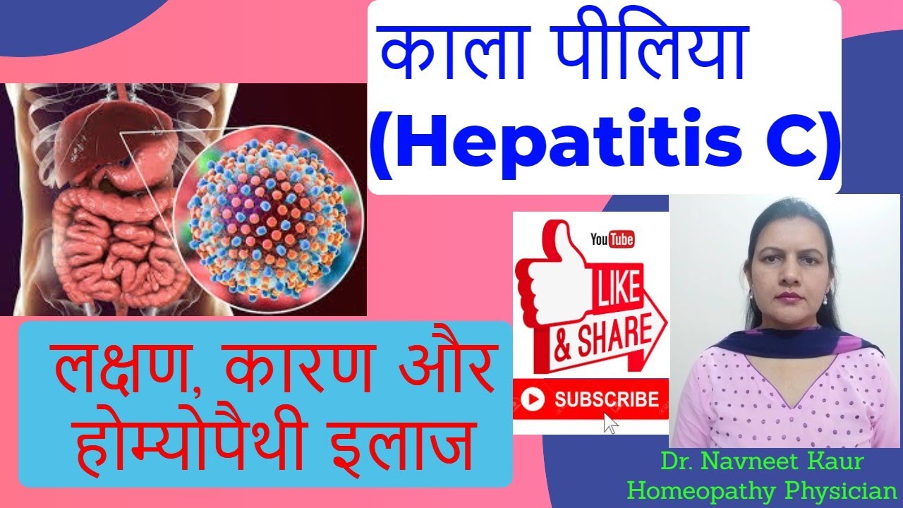 Hepatitis C (काला पीलिया) : Treatment in Homeopathy | कारण,लक्षण तथा होम्योपैथी इलाज