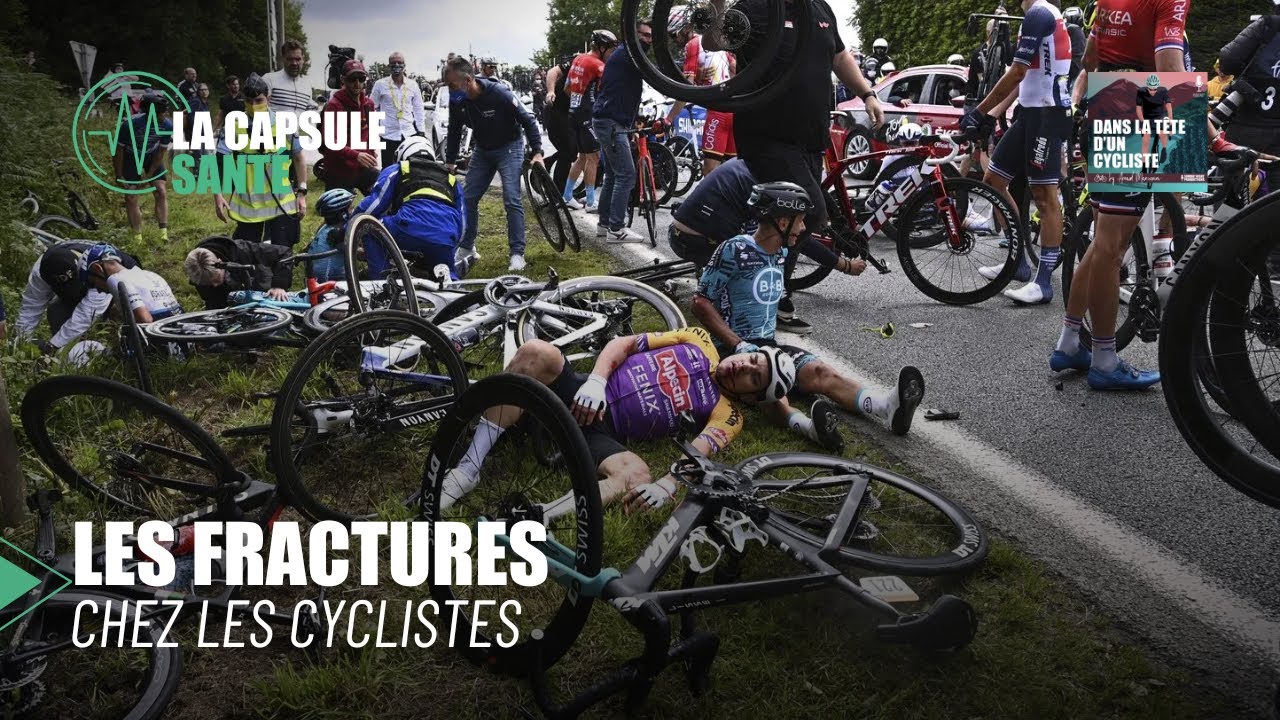 Fractures chez les cyclistes : comment réagir après une chute?