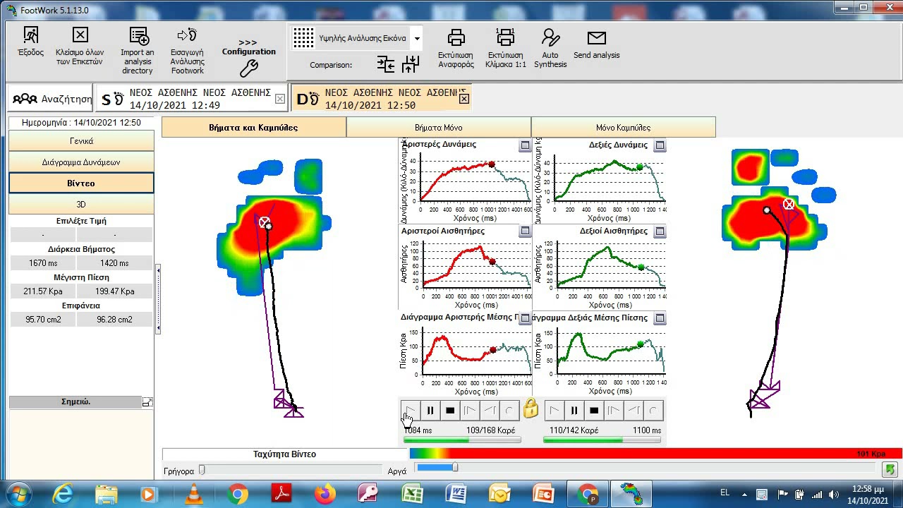 PELMA ANALYSIS - DYNAMIC ANALYSIS