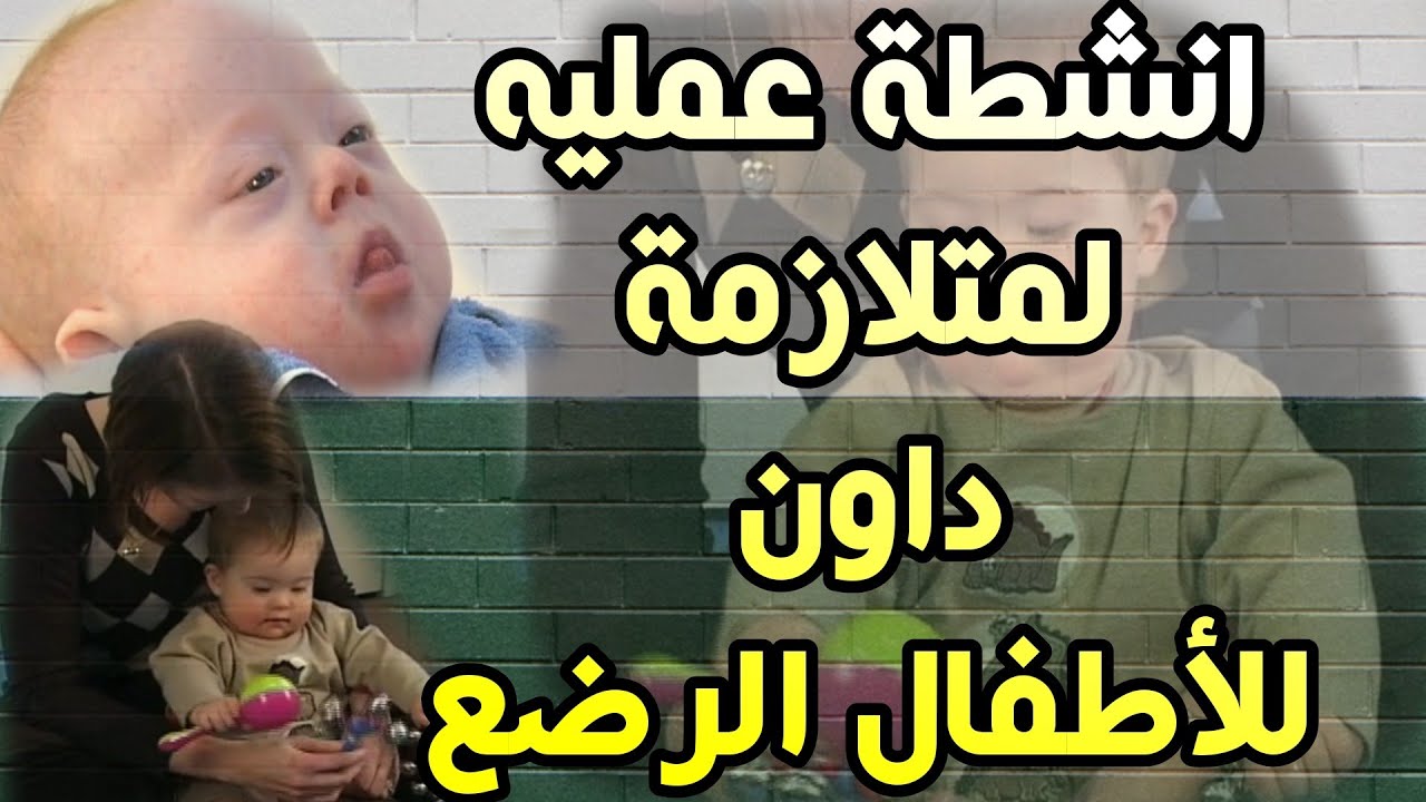 انشطة عمليه لمتلازمة داون الرضع تدخل مبكر | Activities for babies with Down syndrom | النمو البصرى