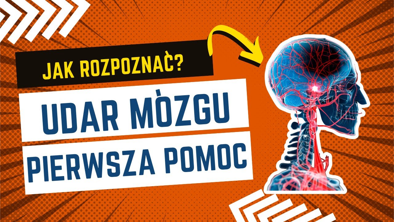 Udar mózgu- pierwsza pomoc🚨 #udar