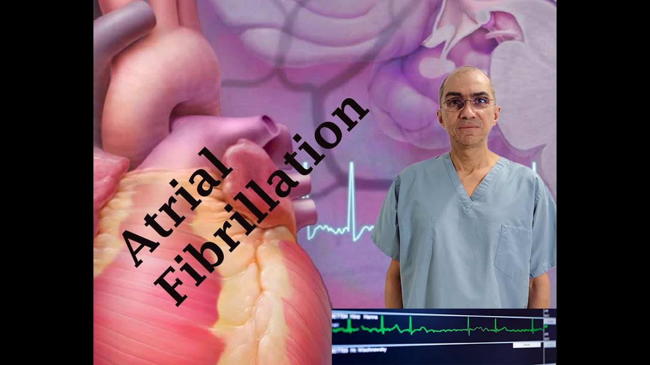 ATRIAL FIBRILLATION Diagnosis and Treatment