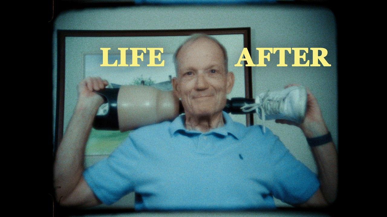 Life After: A Limb Loss Documentary