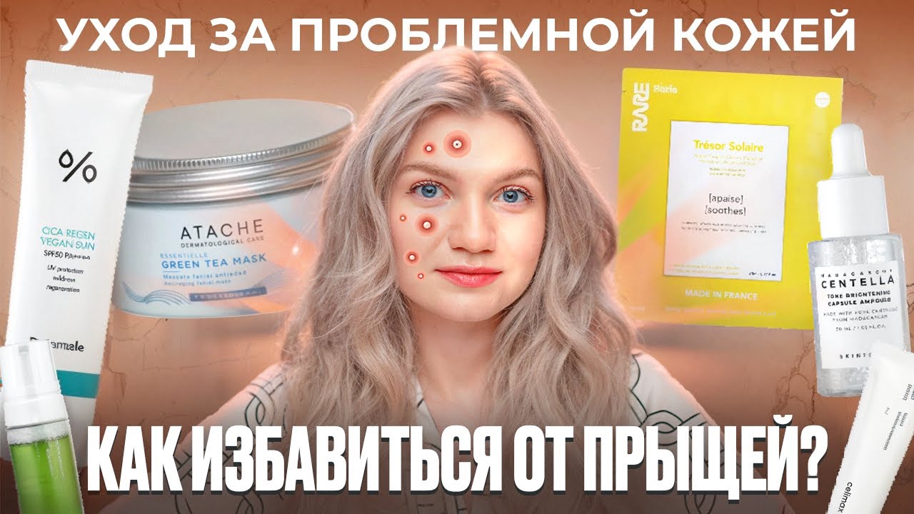 КАК ИЗБАВИТЬСЯ ОТ ПРЫЩЕЙ | УХОД ЗА ПРОБЛЕМНОЙ КОЖЕЙ