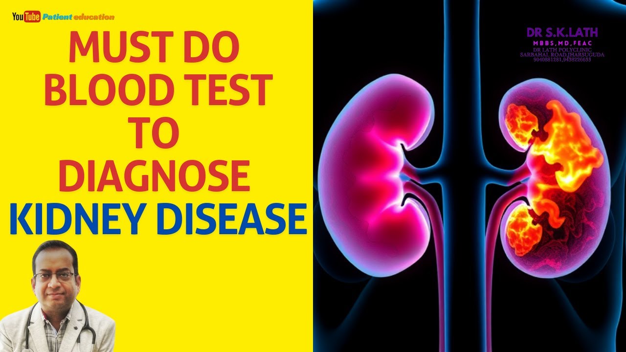 Top Doctor Reveals BEST Blood Tests for Kidney Health