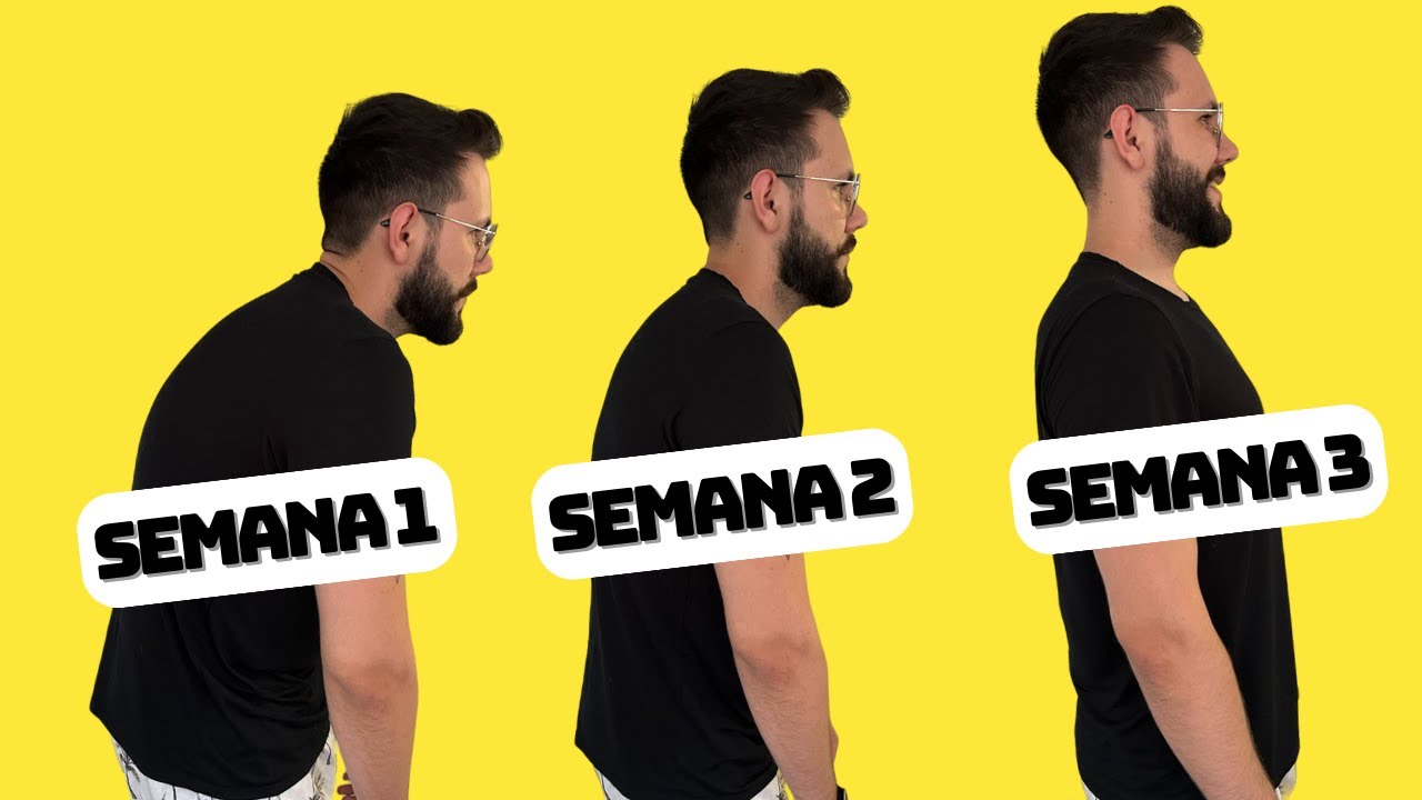 Como melhorar a postura! 4 melhores solu&ccedil;&otilde;es