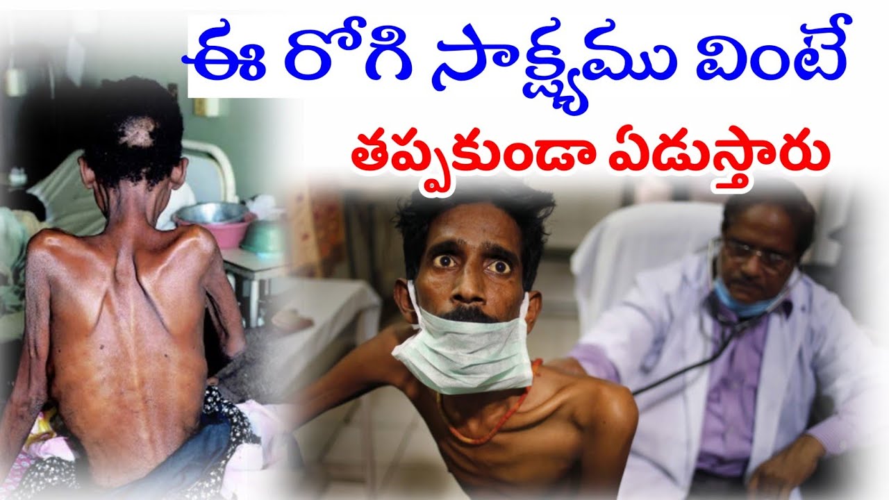 ఈ ఎయిడ్స్ రోగి సాక్ష్యము వింటే కన్నీరు ఏరులై పారుతుంది || గుండెను కదిలించే సాక్ష్యము ||