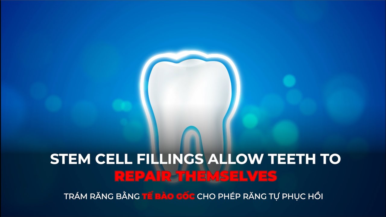 Stem Cell Fillings Allow Teeth to Repair Themselves
