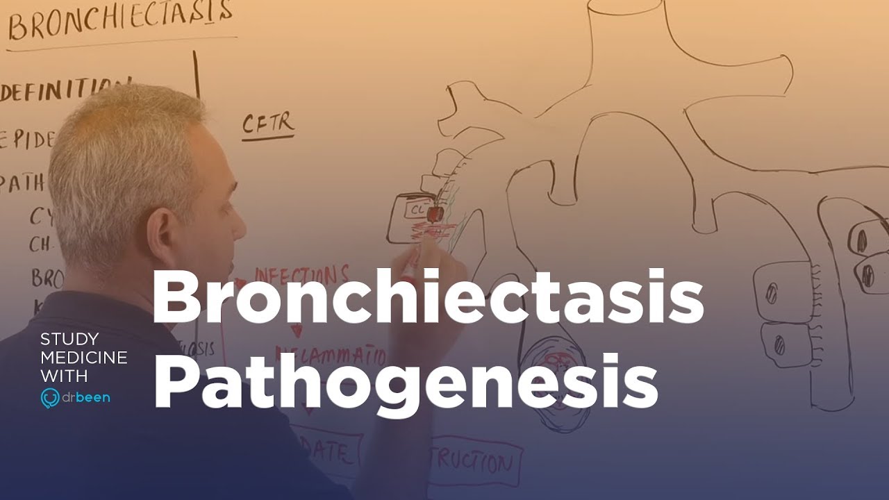 Bronchiectasis Pathophysiology (Cystic Fibrosis Explained)