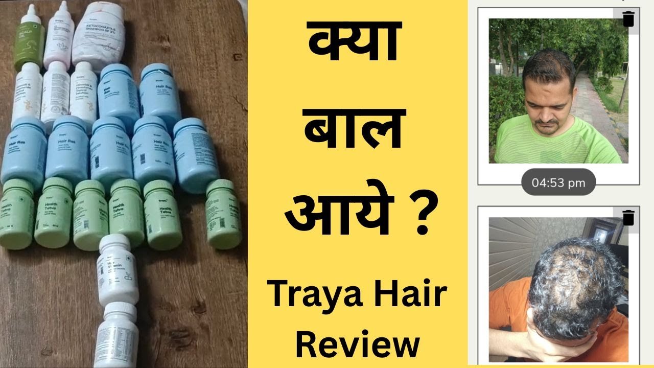 My Traya Hair Review | Is this a Scam | Traya hair treatment honest review