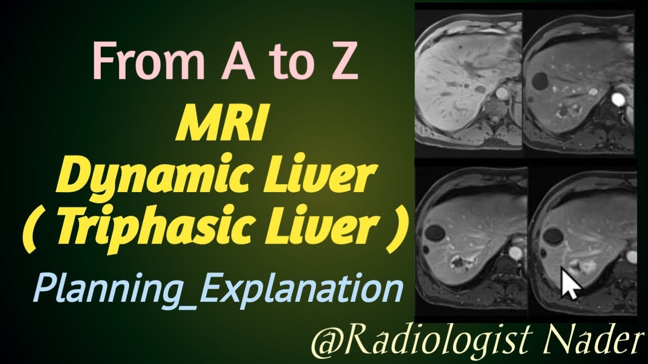 رنين مغناطيسي ديناميكي علي الكبد|رنين ثلاثي المراحل علي الكبد|MRI Dynamic Liver|MRI Triphasic liver