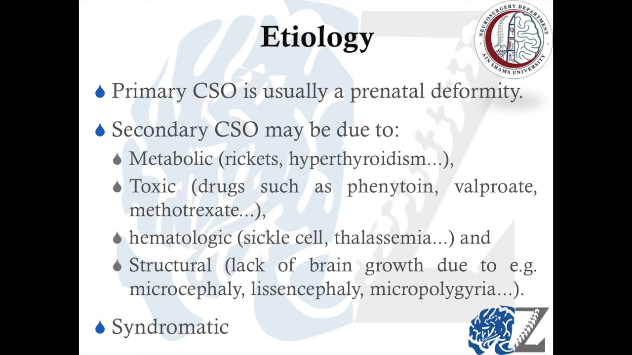 Craniosinostosis (Part 1) تعظم الجمجمة المبكر