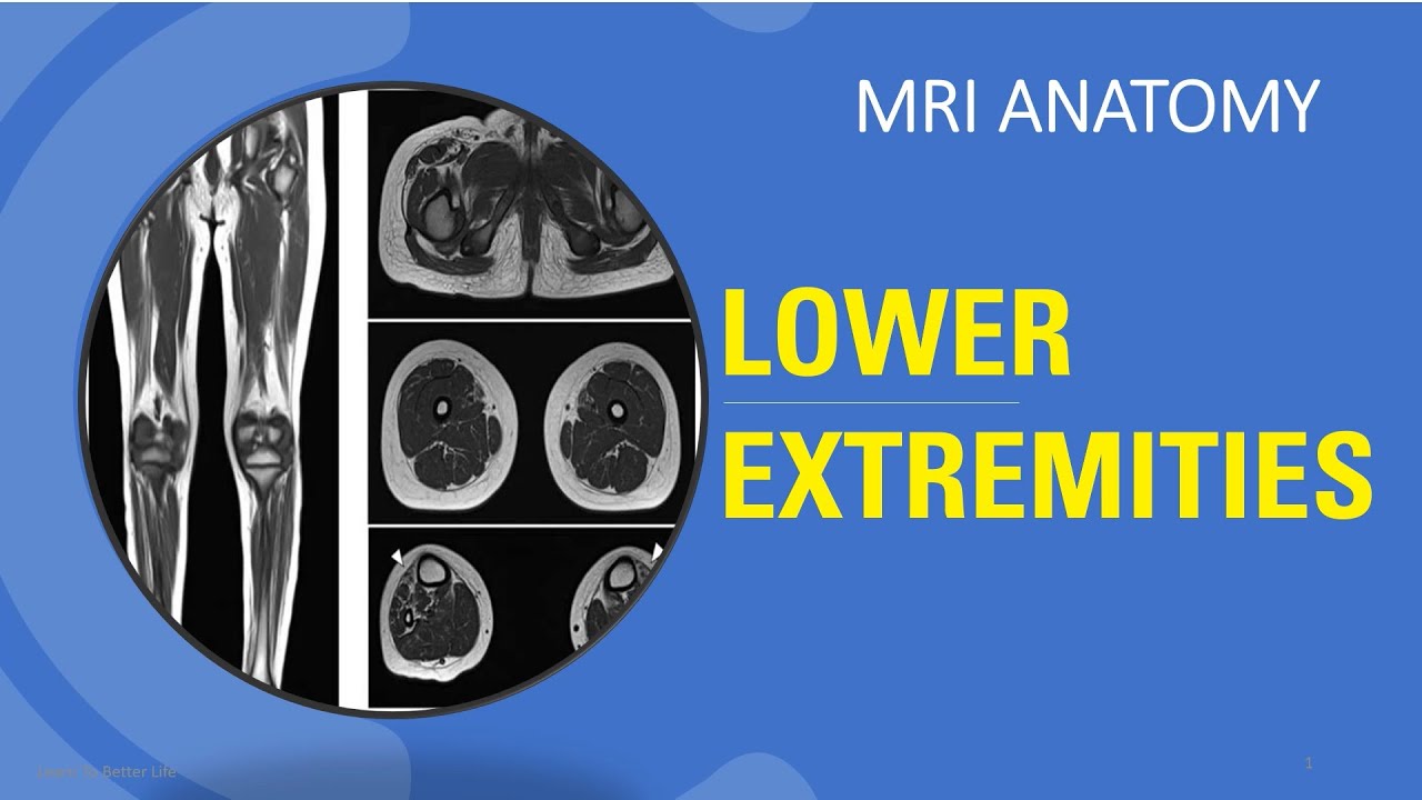 MRI Board Review - Lower Extremities Anatomy